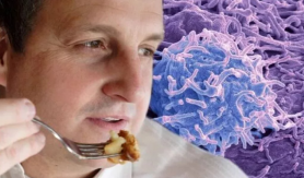 5 alimente care pot provoca cancer. Specialiștii nu le recomandă pentru consum